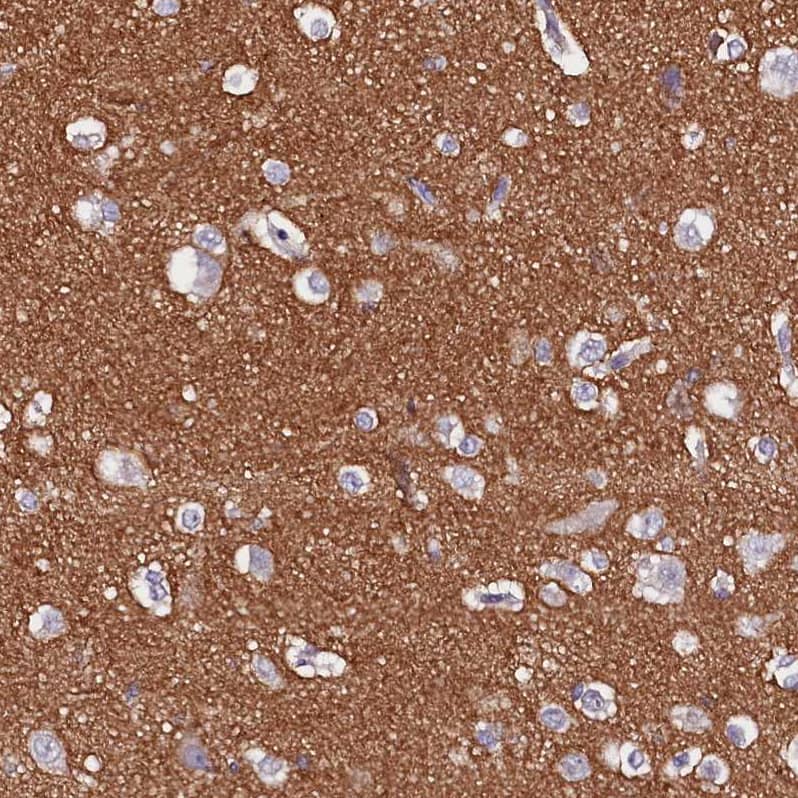 Staining of human cerebral cortex shows strong cytoplasmic/ cytoplasmic membranous positivity in neuropil.