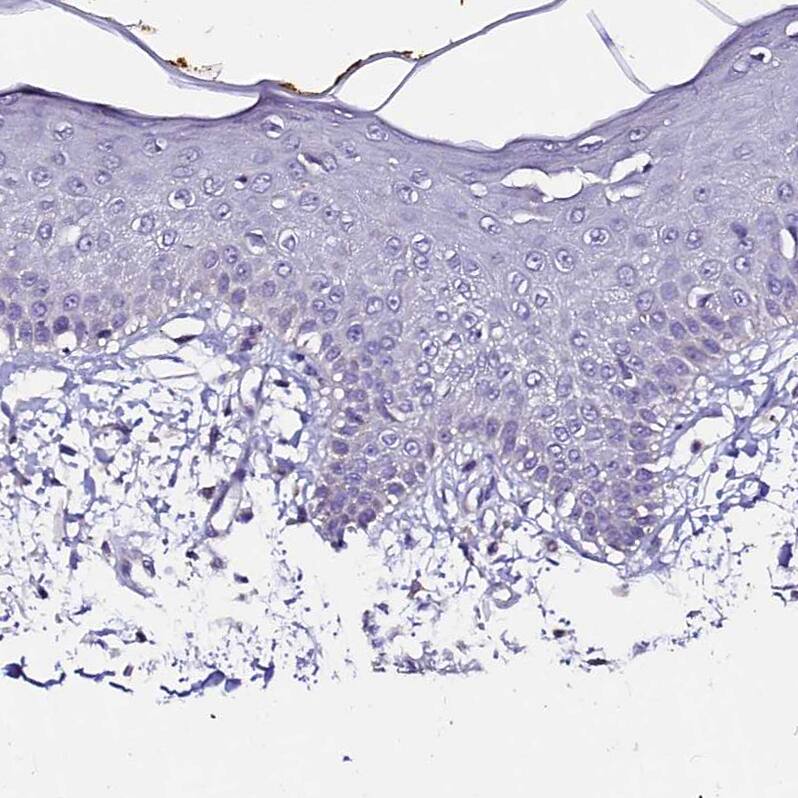 Staining of human skin shows no positivity in squamous epithelial cells as expected.