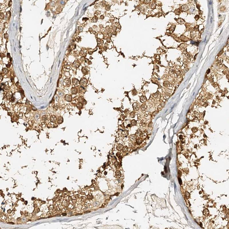 Staining of human testis shows strong cytoplasmic positivity in cells in seminiferus ducts.