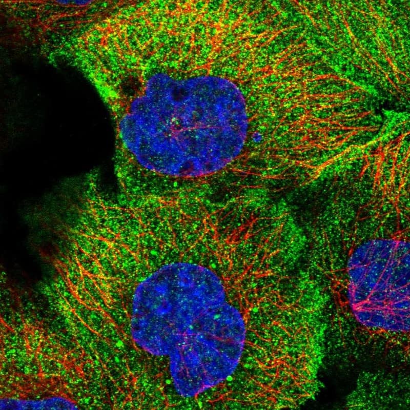 Staining of human cell line A-431 shows localization to plasma membrane & cytosol.