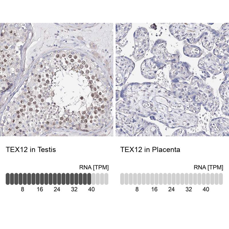 Analysis in human testis and placenta tissues using NBP1-90989 antibody. Corresponding TEX12 RNA-seq data are presented for the same tissues.