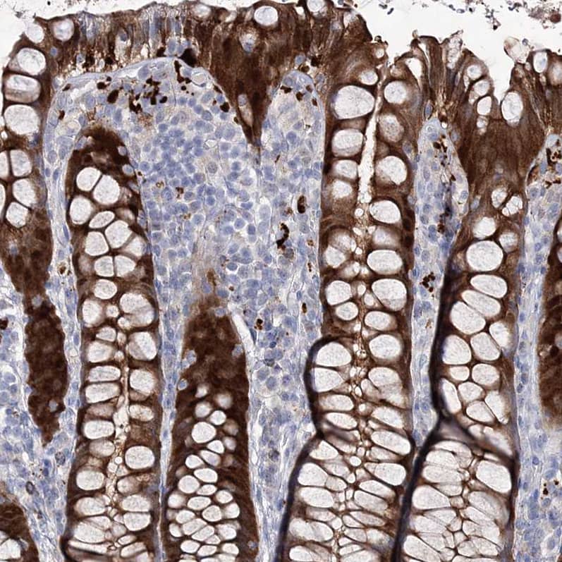Immunohistochemistry UDP glucose dehydrogenase Antibody - BSA Free