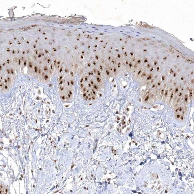 Staining of human skin shows strong nuclear/nucleoli positivity in squamous epithelial cells.