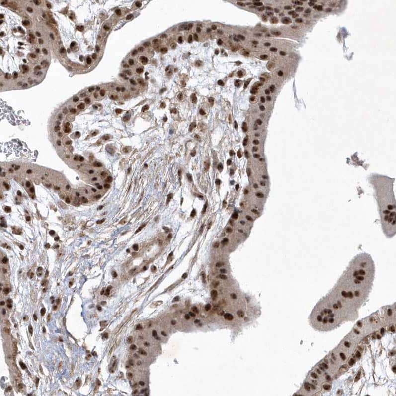 Staining of human placenta shows strong nuclear/nucleoli positivity in trophoblastic cells.