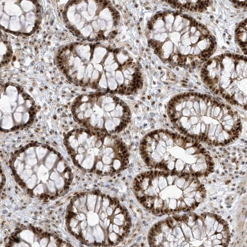 Staining of human colon shows strong nuclear/nucleoli positivity in glandular cells and lymphoid cells.
