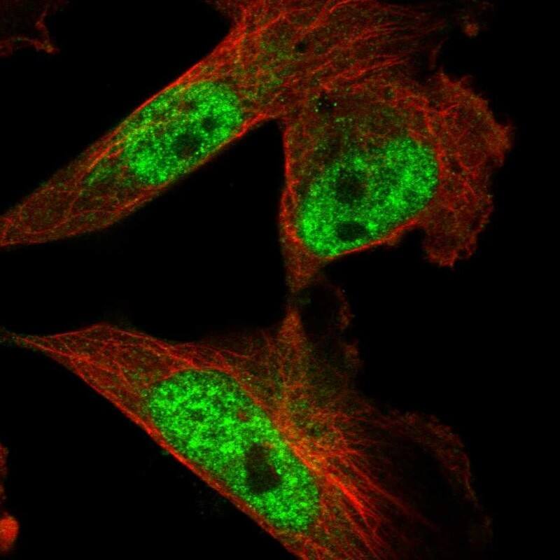 Staining of human cell line U-251 MG shows localization to nuclear speckles.