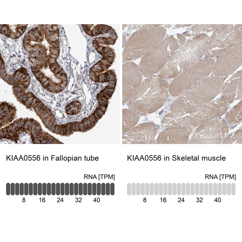 Analysis in human fallopian tube and skeletal muscle tissues using Anti-KIAA0556 antibody. Corresponding KIAA0556 RNA-seq data are presented for the same tissues.