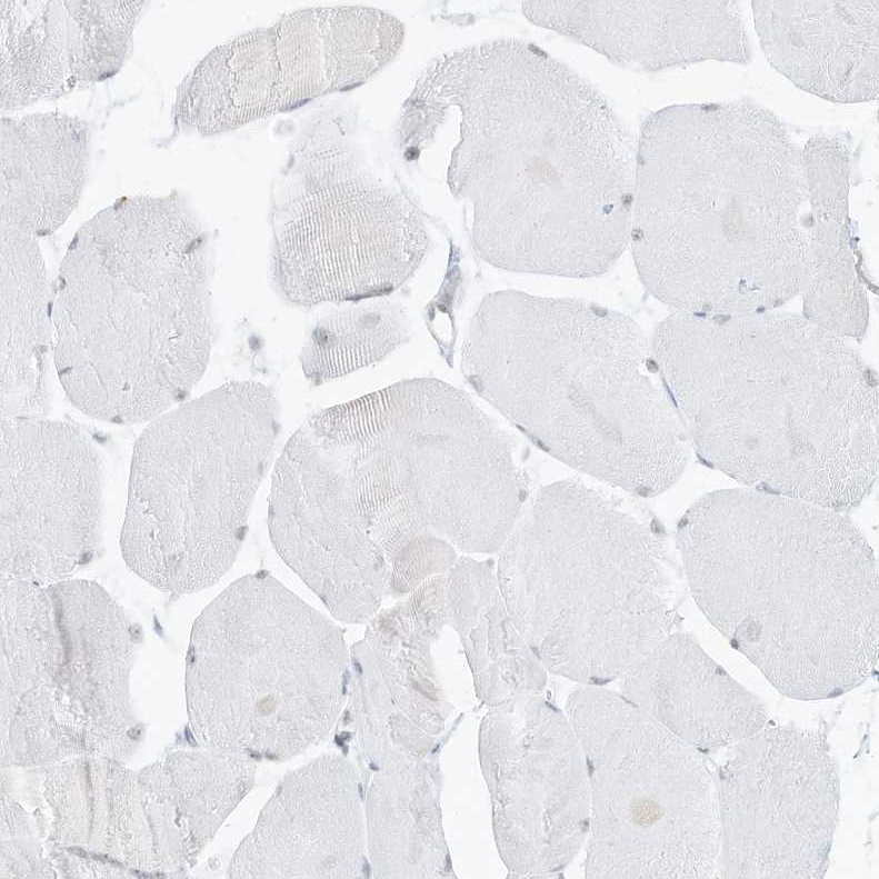 Staining of human skeletal muscle shows no positivity in myocytes as expected.