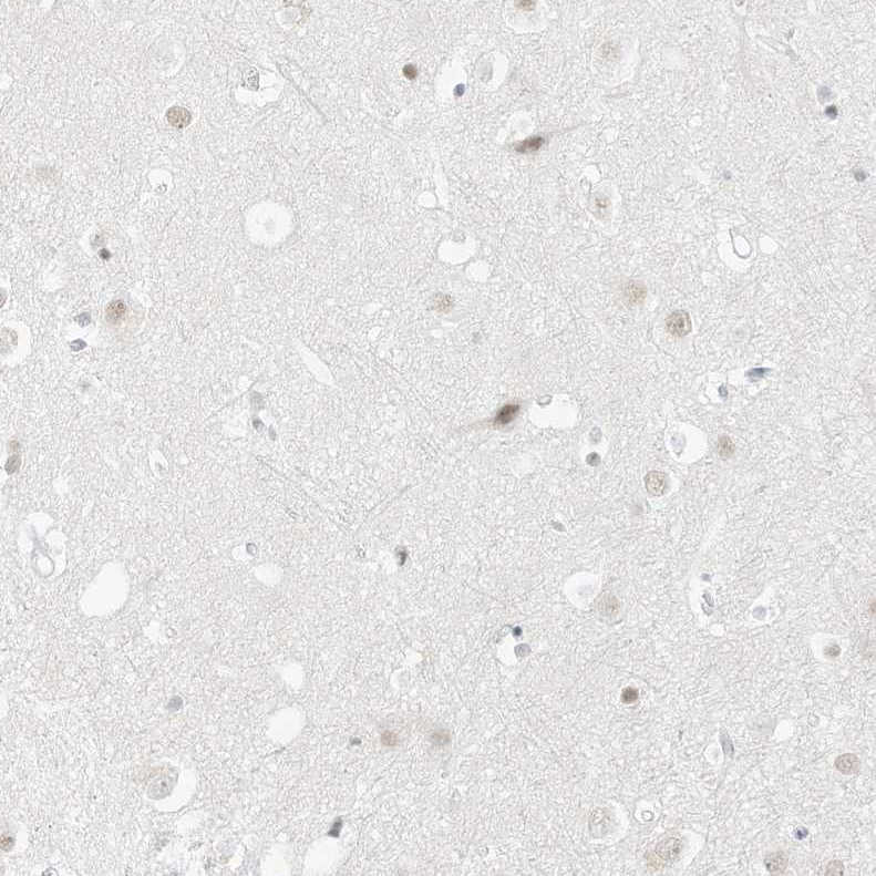 Staining of human cerebral cortex shows no positivity in neurons as expected.