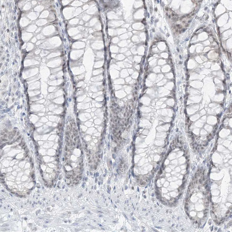 Staining of human colon shows low positivity in glandular cells as expected.