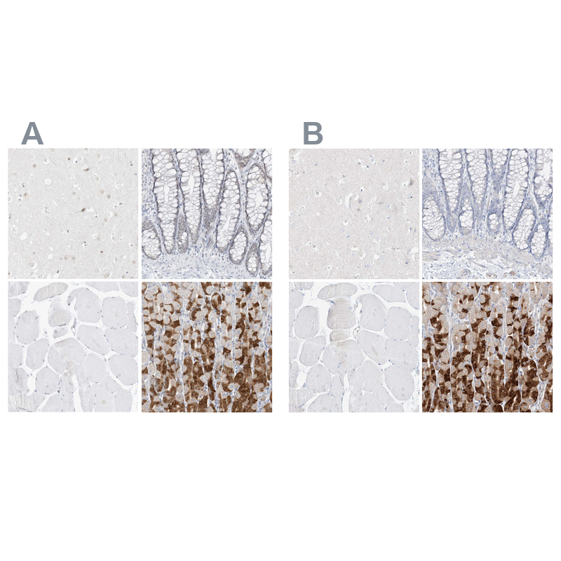 Staining of human cerebral cortex, colon, skeletal muscle and stomach HPA031718 (A) shows similar protein distribution across tissues to independent antibody HPA031717 (B).