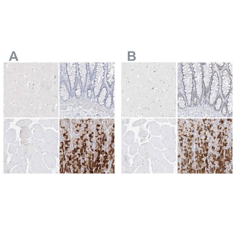 <b>Orthogonal Strategies Validation. </b>Staining of human cerebral cortex, colon, skeletal muscle and stomach HPA031717 (A) shows similar protein distribution across tissues to independent antibody HPA031718 (B).