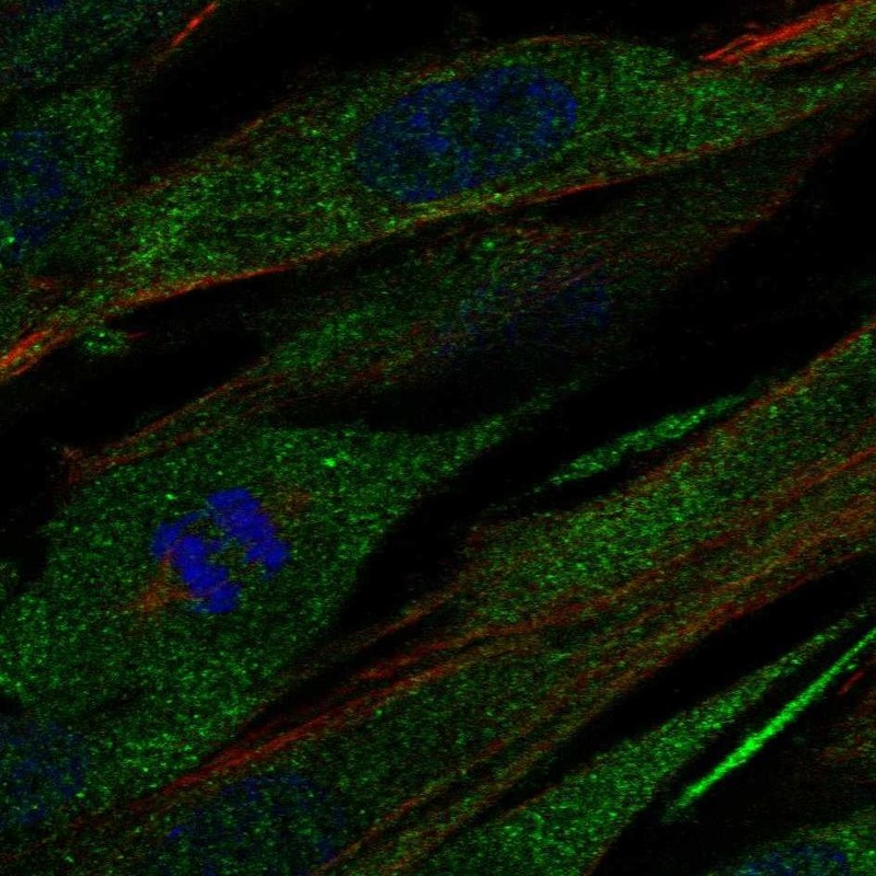 Immunocytochemistry/ Immunofluorescence Collagen XXI Antibody - BSA Free
