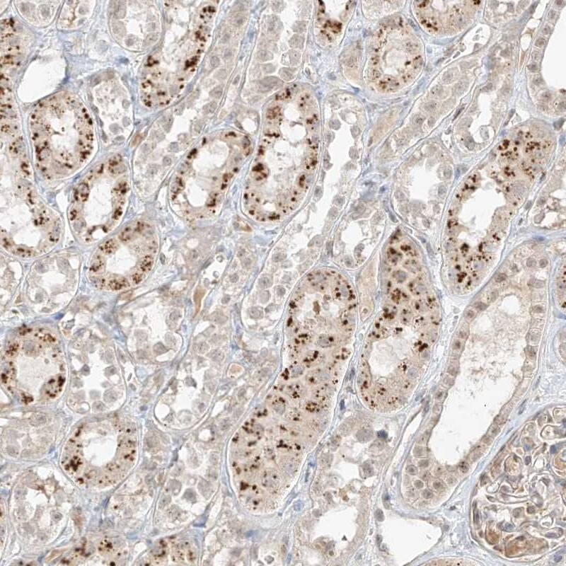 Staining of human kidney shows strong granular positivity in tubular cells.