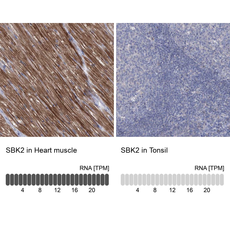 Analysis in human heart muscle and tonsil tissues using NBP1-91020 antibody. Corresponding SBK2 RNA-seq data are presented for the same tissues.