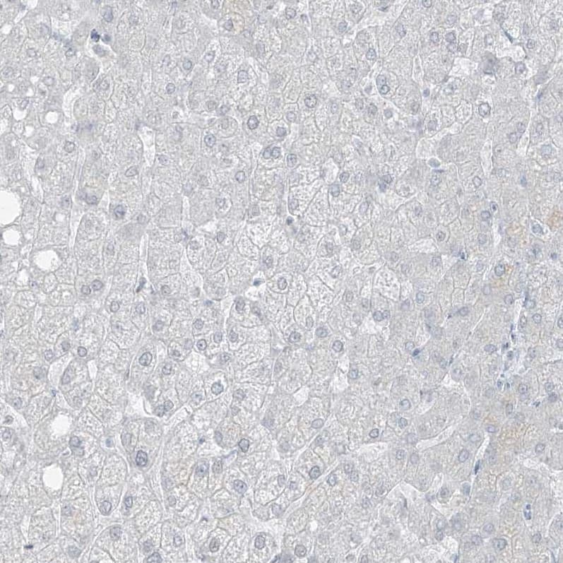 Staining of human liver shows no positivity in hepatocytes as expected.