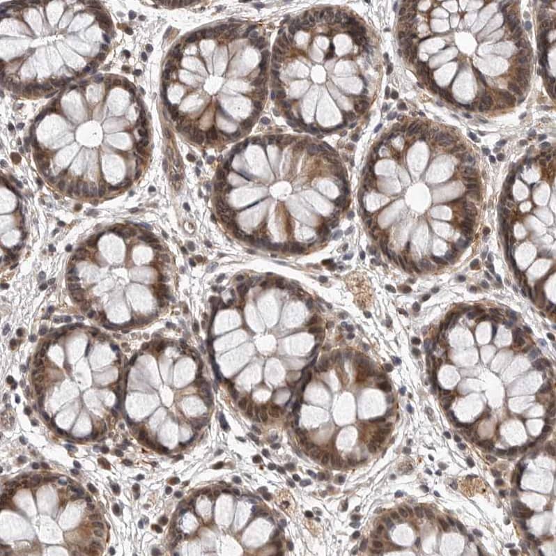 Immunohistochemistry KIAA1614 Antibody - BSA Free