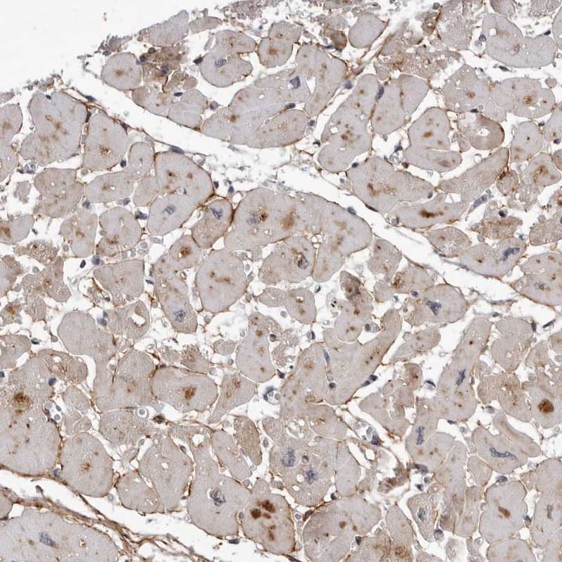 Immunohistochemistry KIAA1614 Antibody - BSA Free