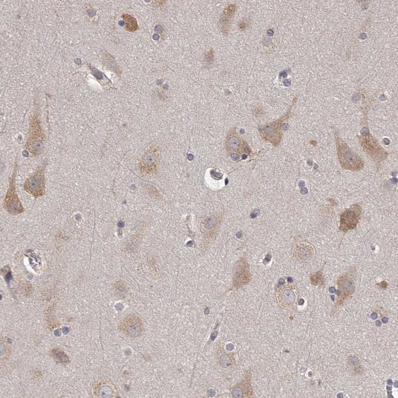 Staining of human cerebral cortex shows weak to moderate cytoplasmic positivity in neurons.