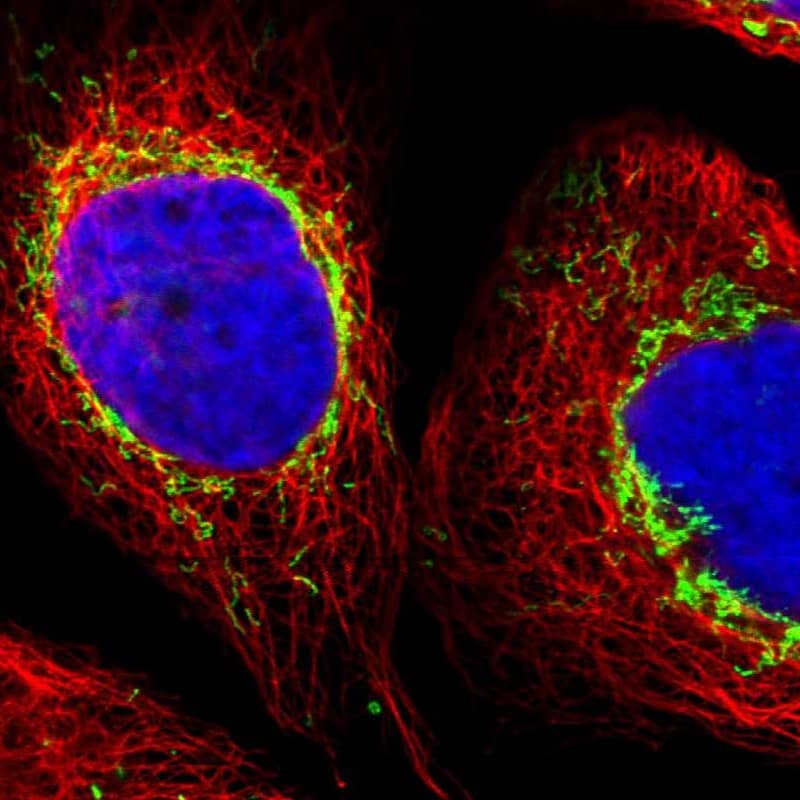 Staining of human cell line A-431 shows localization to mitochondria.