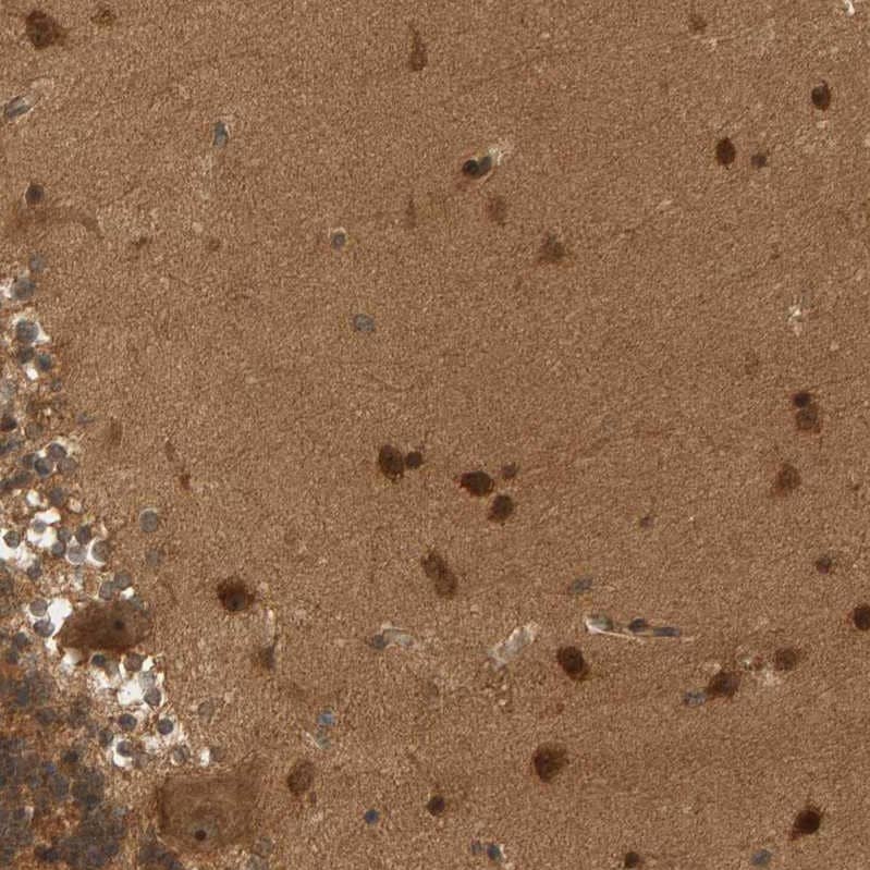 Staining of human cerebellum shows strong positivity in nucleoli and cytoplasm in Purkinje cells and cells in molecular layers.