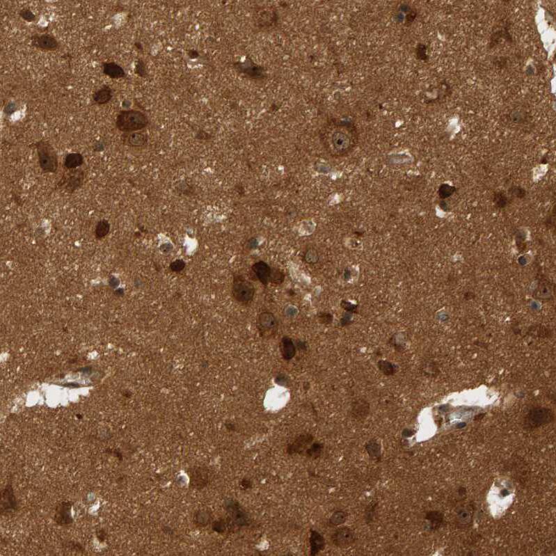 Staining of human cerebral cortex shows strong positivity in nucleoli in neuronal cells.