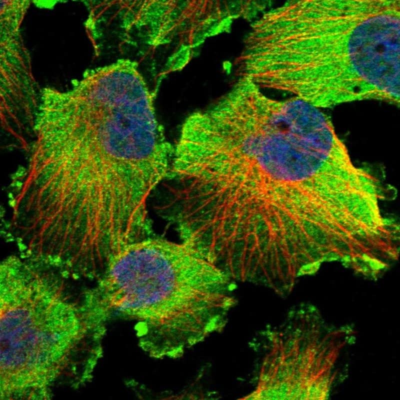Staining of human cell line U-251 MG shows localization to plasma membrane & cytosol.