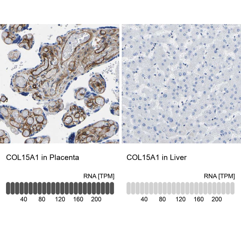 Immunohistochemistry-Paraffin COL15A1 Antibody - BSA Free
