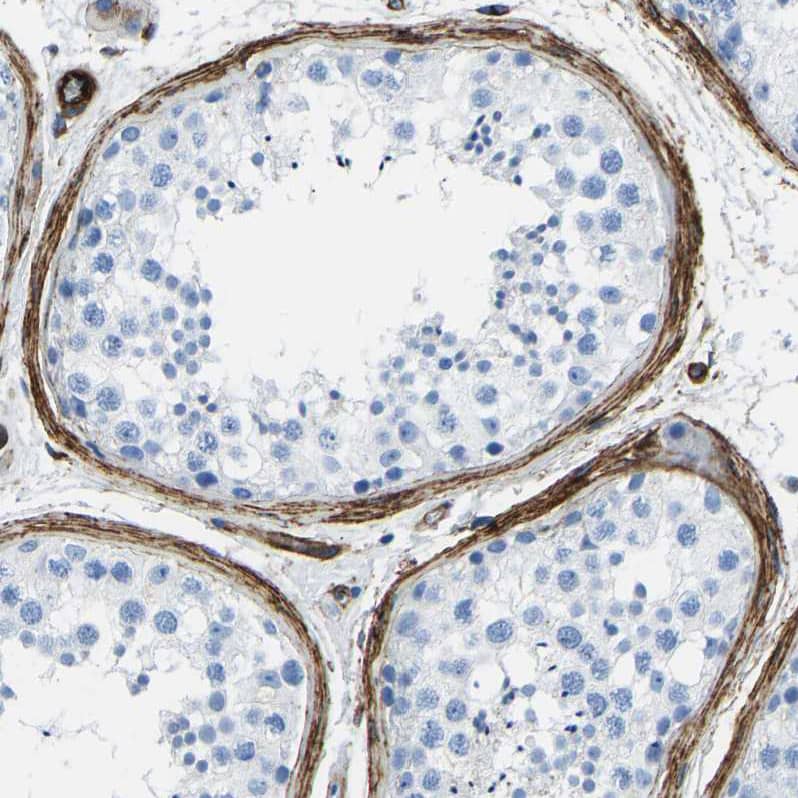 Immunohistochemistry-Paraffin COL15A1 Antibody - BSA Free