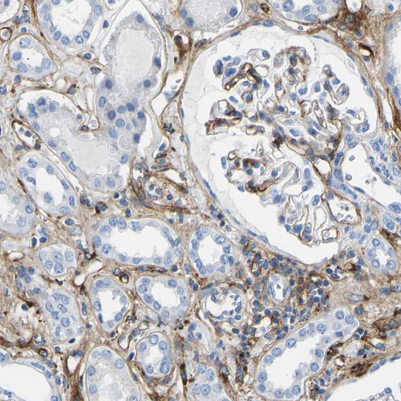 Immunohistochemistry-Paraffin COL15A1 Antibody - BSA Free