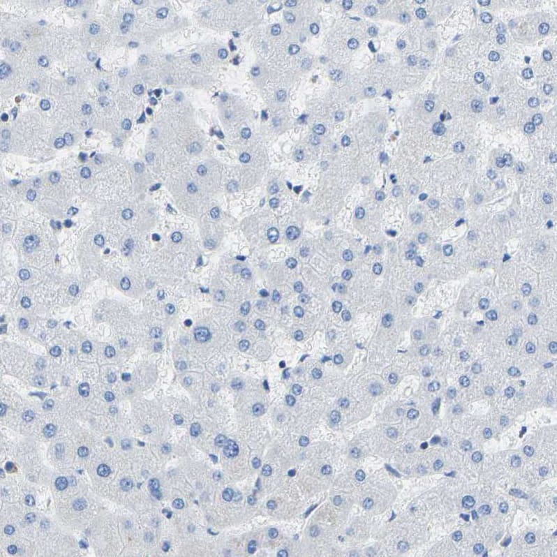 Immunohistochemistry-Paraffin COL15A1 Antibody - BSA Free