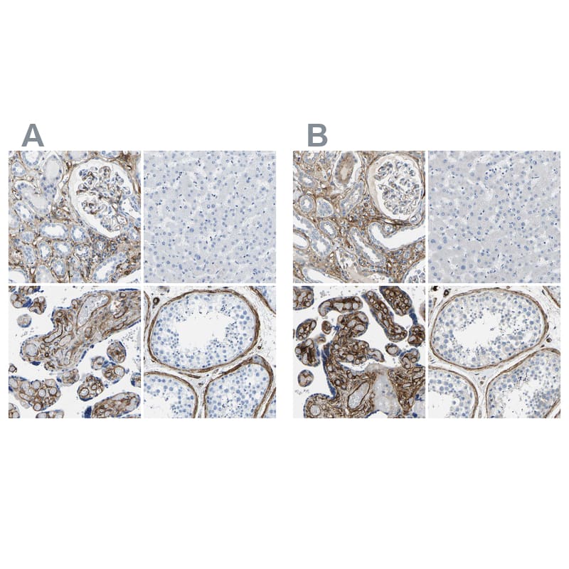 Immunohistochemistry-Paraffin COL15A1 Antibody - BSA Free