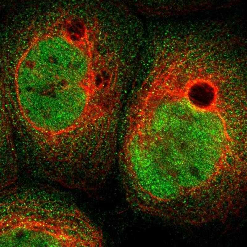 Immunocytochemistry/ Immunofluorescence ABHD15 Antibody - BSA Free