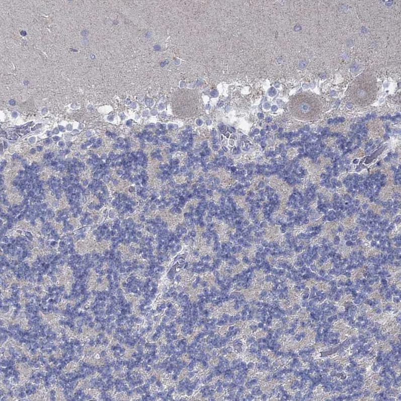 Staining of human cerebellum shows no positivity in Purkinje cells as expected.