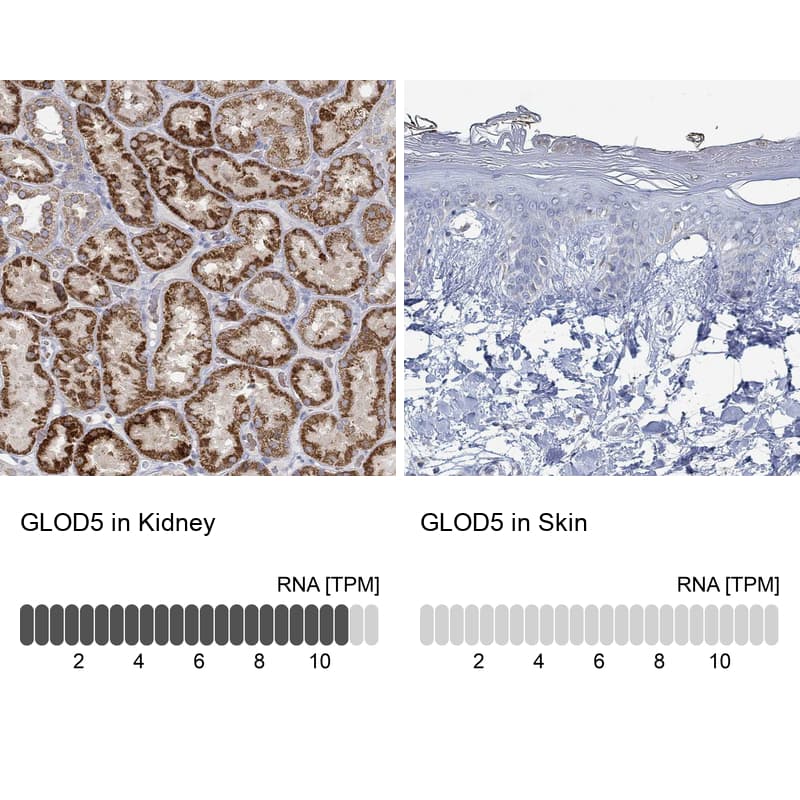 <b>Orthogonal Strategies Validation. </b>Analysis in human kidney and skin tissues using NBP1-91105 antibody. Corresponding GLOD5 RNA-seq data are presented for the same tissues.
