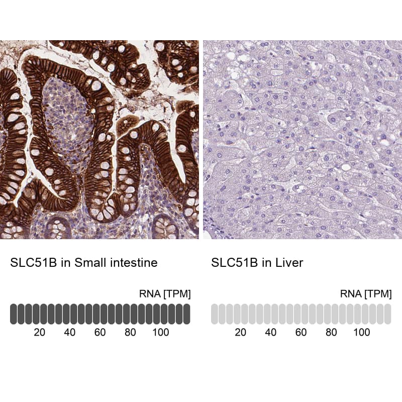 Analysis in human small intestine and liver tissues using NBP1-91108 antibody. Corresponding SLC51B RNA-seq data are presented for the same tissues.