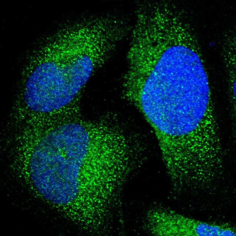 Staining of human cell line U-2 OS shows localization to cytosol.