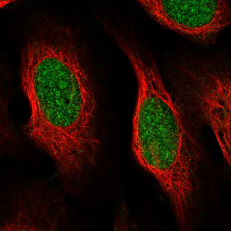 Immunocytochemistry/ Immunofluorescence CCDC175 Antibody - BSA Free