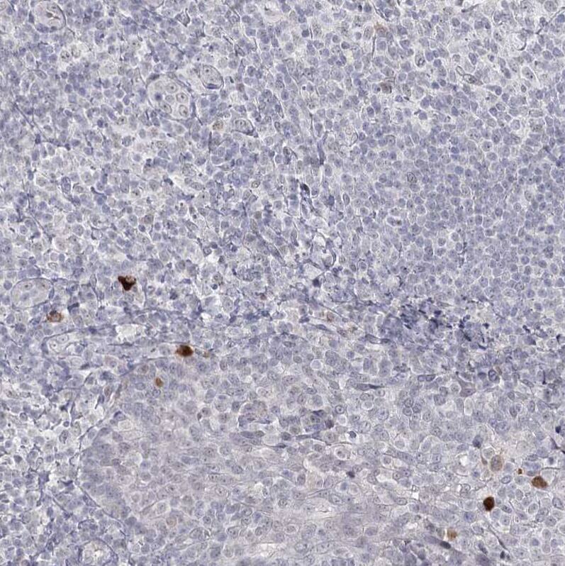 Immunohistochemistry-Paraffin Ly-6G5C Antibody - BSA Free