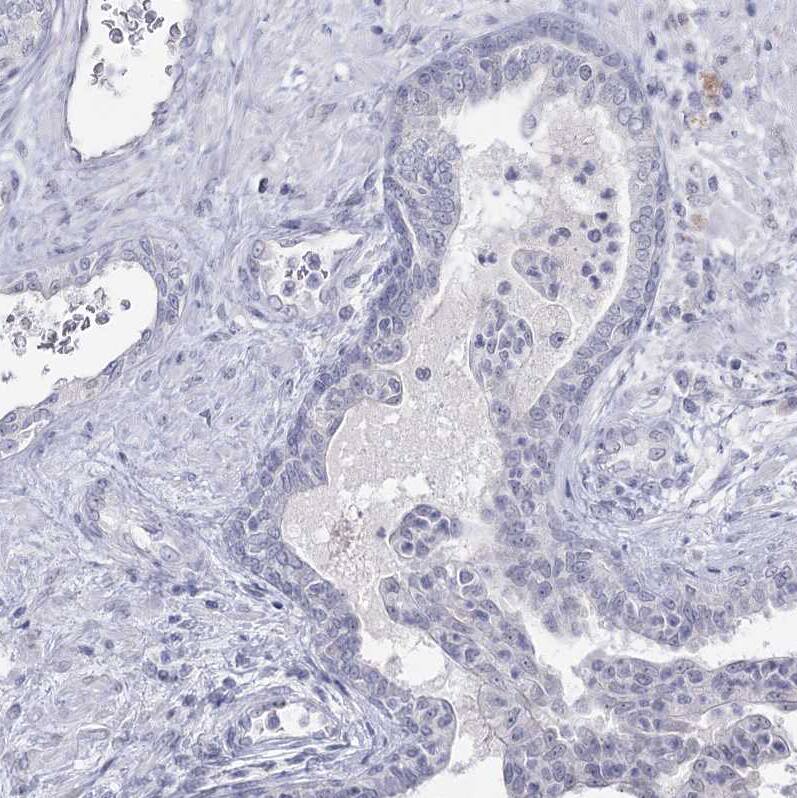 Immunohistochemistry-Paraffin Ly-6G5C Antibody - BSA Free