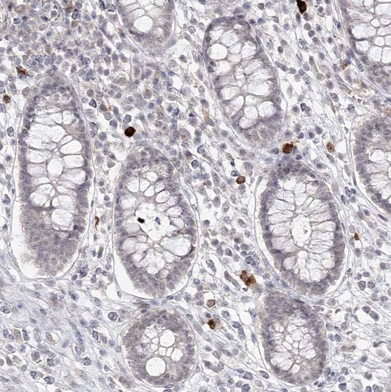 Immunohistochemistry-Paraffin Ly-6G5C Antibody - BSA Free