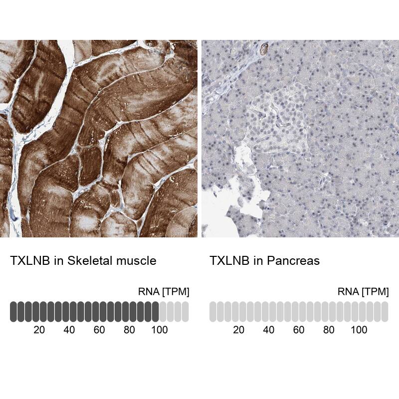 <b>Orthogonal Strategies Validation. </b>Analysis in human skeletal muscle and pancreas tissues.