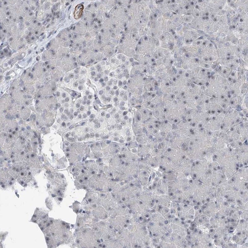 Staining of human pancreas shows low expression as expected.