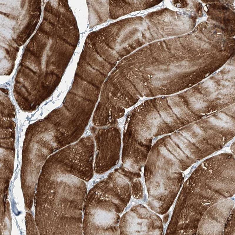 Staining of human skeletal muscle shows high expression.