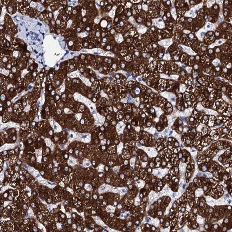 Immunohistochemistry-Paraffin Glycogen synthase 2 Antibody - BSA Free