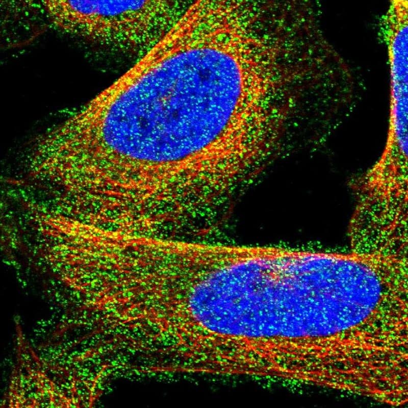 Staining of human cell line U-2 OS shows localization to cytosol.