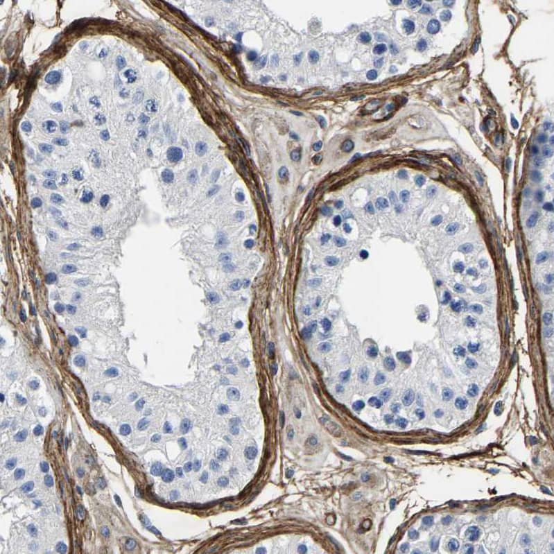 Staining of human testis shows strong membranous positivity in collagen fibers.