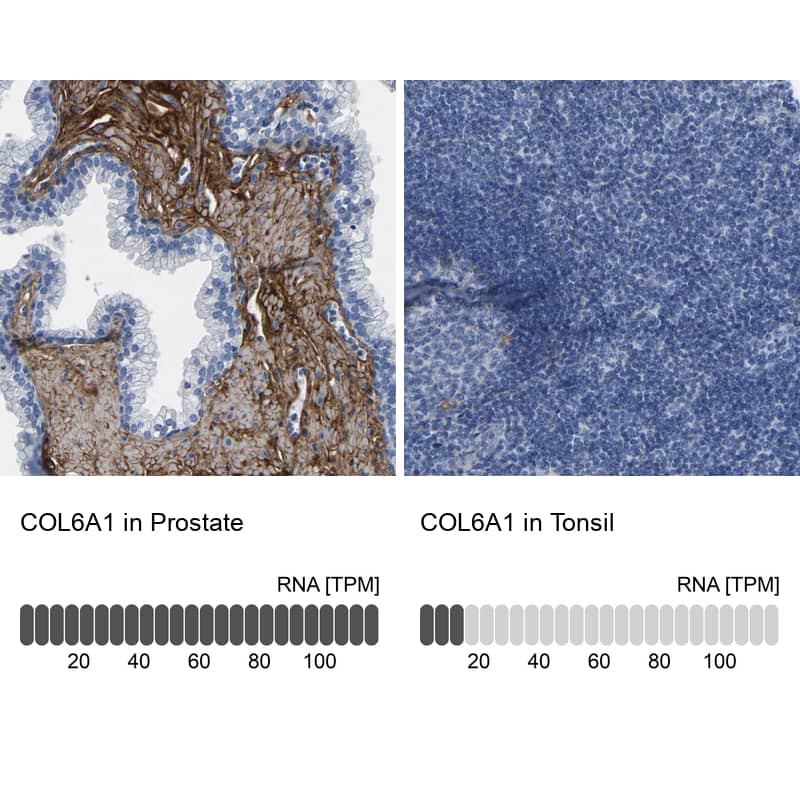 <b>Orthogonal Strategies Validation. </b>Analysis in human prostate and tonsil tissues using NBP1-91195 antibody. Corresponding COL6A1 RNA-seq data are presented for the same tissues.