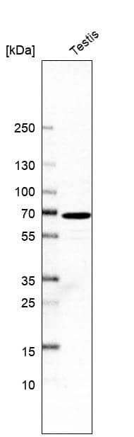 Analysis in human testis tissue.