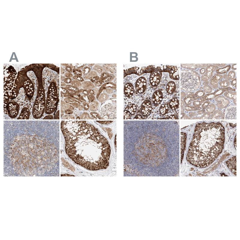 <b>Orthogonal Strategies Validation. </b>Staining of human gastrointestinal, kidney, lymphoid tissues and testis HPA029039 (A) shows similar protein distribution across tissues to independent antibody HPA029038 (B).